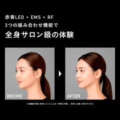 エレキブラシプラス 2