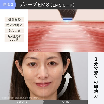 マイトレックス　美顔器