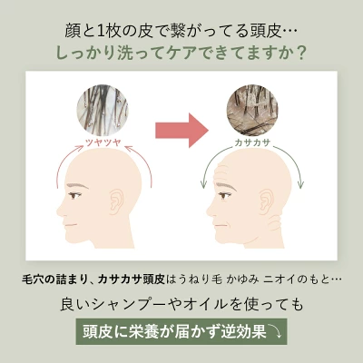 AKN/R (アクニー)