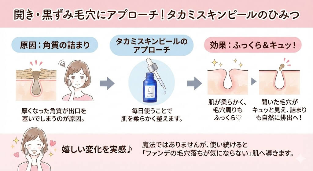 タカミスキンピールは開き毛穴・黒ずみ毛穴へアプローチしてくれる